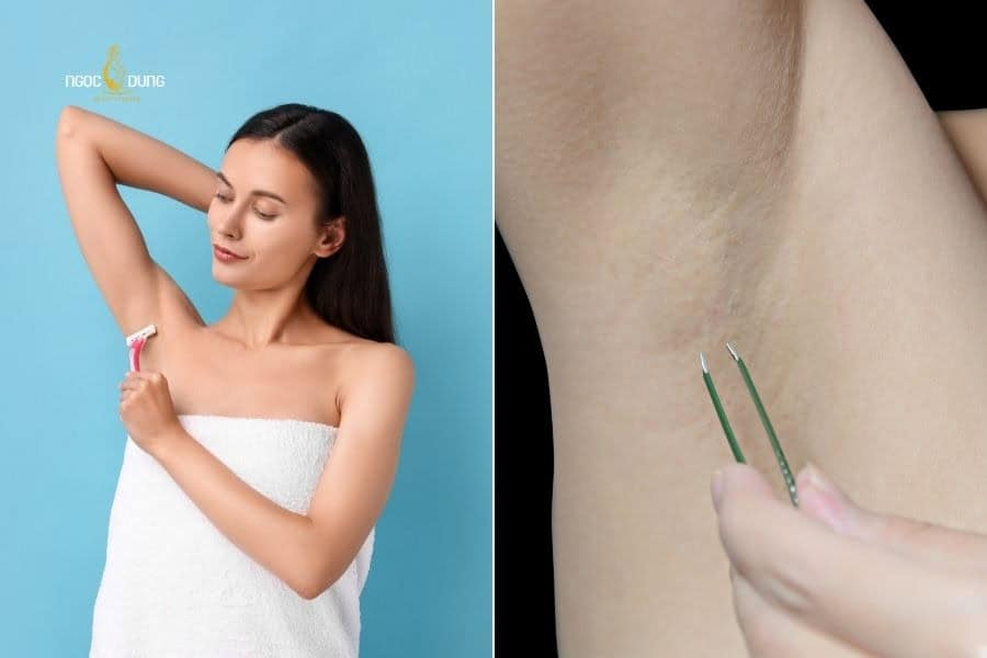 Ảnh hưởng cơ học của mới nhổ và cạo lông nách là giải đáp cho thắc mắc tại sao mọc lông nách lại ngứa
