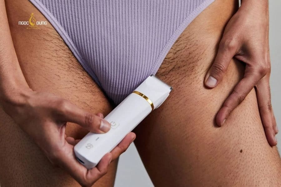 Lông vùng kín có tác dụng gì? Những lưu ý cần biết 6 Chỉ nên cạo lông vùng kín khi có chỉ định từ bác sĩ hoặc cản trở việc vệ sinh hằng ngày