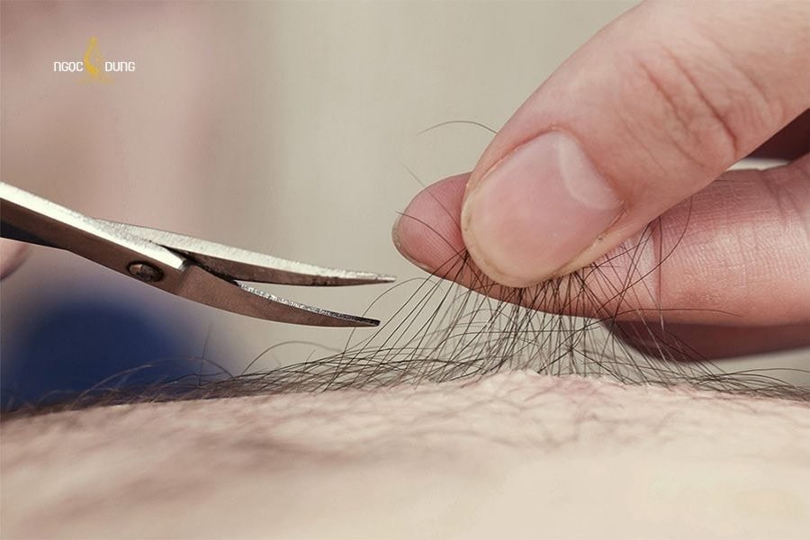 Đang có kinh có triệt lông được không? Lưu ý an toàn 6 Chỉ nên cắt tỉa gọn gàng lông vùng kín vào ngày dâu