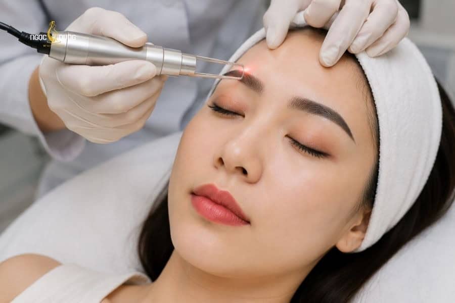 Kết quả xóa xăm còn phụ thuộc vào công nghệ sử dụng
