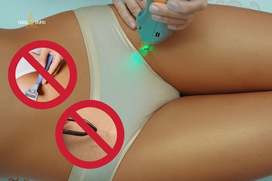 Những lưu ý sau khi triệt lông bikini bạn cần biết 5 Không tự ý cạo hoặc nhổ lông bikini khi đã đi liệu trình triệt lông