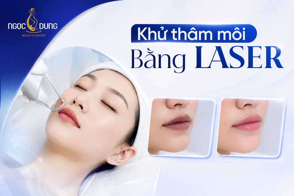 Khử thâm môi bằng Laser