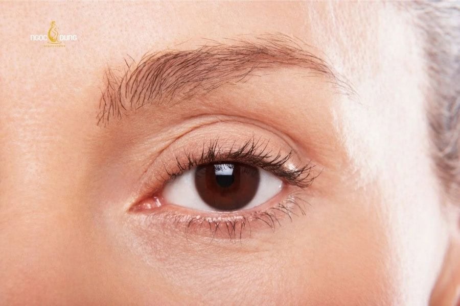 Luôn theo dõi phản ứng của vùng mắt khi thực hiện những cách xóa xăm mí mắt tại nhà
