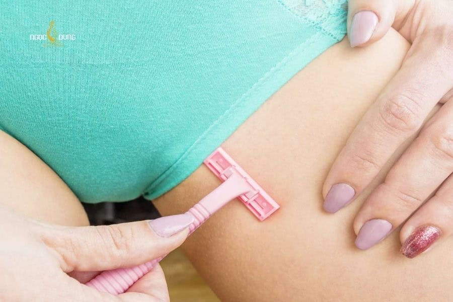 Cạo hoặc waxing không đúng cách là nguyên nhân phổ biến gây ra lông mọc ngược ở vùng kín