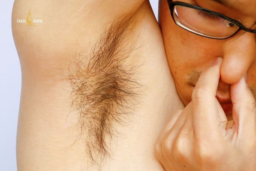 Tại sao lông nách mọc nhanh? Cách làm giảm tốc độ lông mọc 5 Lông nách mọc nhiều dễ gây ra mùi cơ thể khó chịu