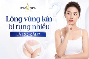 Lông vùng kín bị rụng