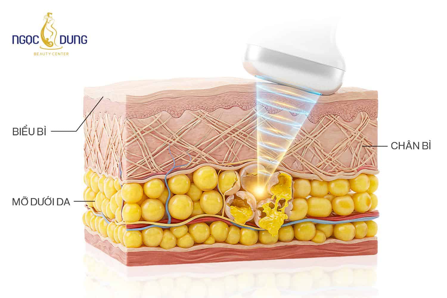 Nguyên lý hoạt động của công nghệ Biolift Matrix