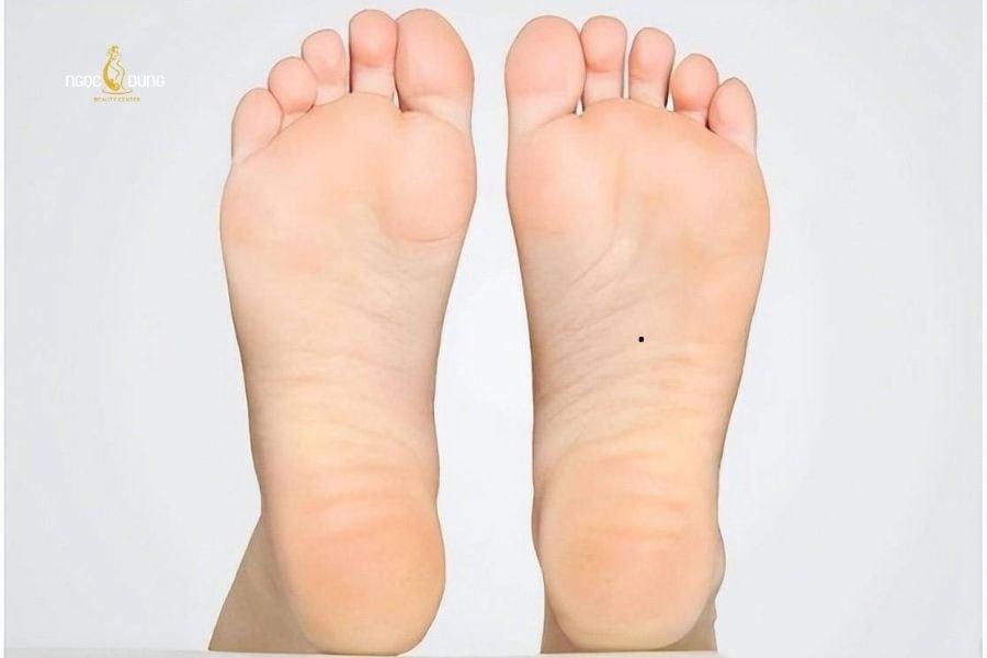 Nốt ruồi ở lòng bàn chân phải nữ giới​ thường mang ý nghĩa cô gái “giỏi việc nước, đảm việc nhà”