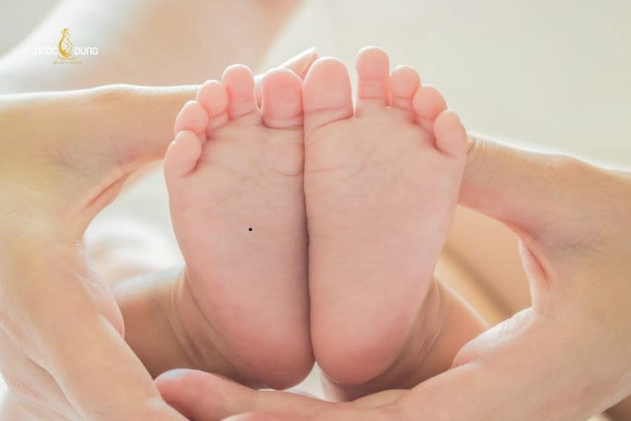 Nốt ruồi ở lòng bàn chân nam và nữ là tốt hay xấu? 2 Nốt ruồi ở lòng bàn chân thường được đánh giá là điều tốt theo quan niệm dân gian