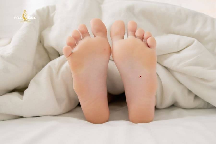 Nốt ruồi ở lòng bàn chân nam và nữ là tốt hay xấu? 5 Nốt ruồi son ở lòng bàn chân thường mang ý nghĩa “phú quý”