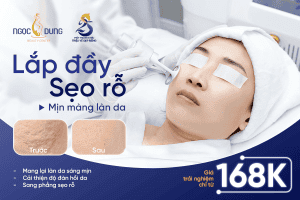 seo ro