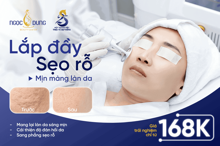 seo ro