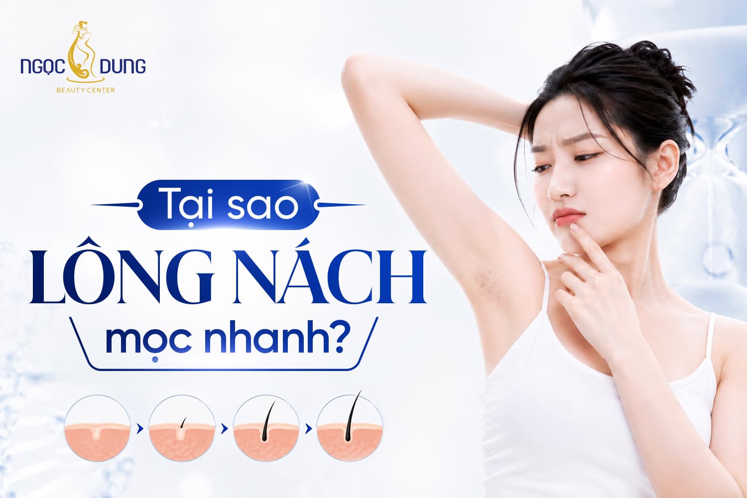 Tại sao lông nách mọc nhanh?