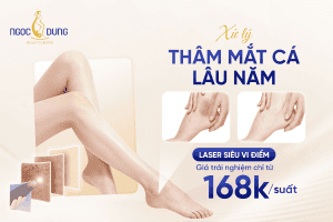 tham mat ca chan