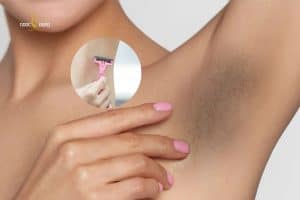 Vùng da dưới cánh tay có thể bị thâm do cạo sai kỹ thuật