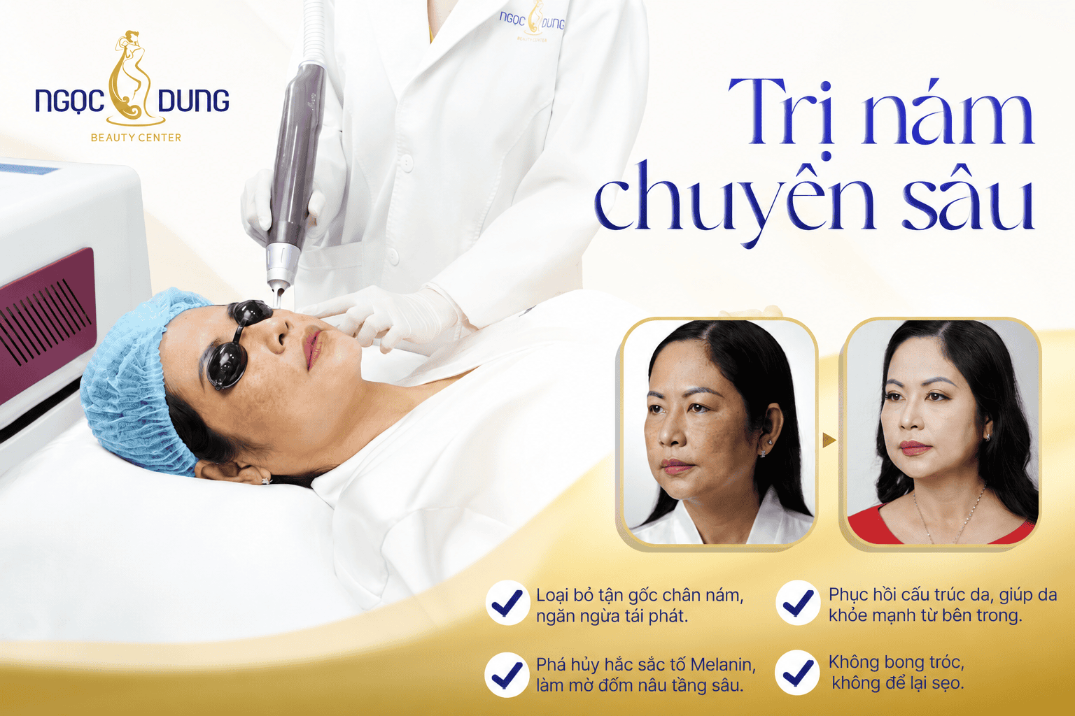 tri nam chuyen sau