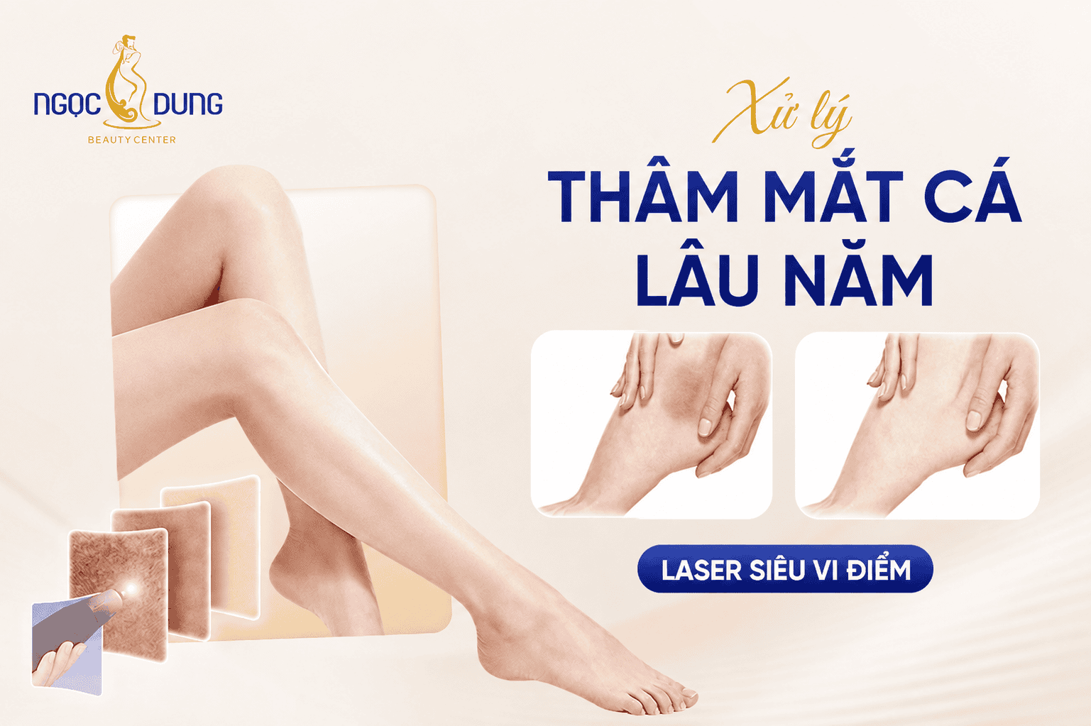 Dịch Vụ Trị Thâm Mắt Cá Chân Hiệu Quả Giúp Tự Tin Hơn