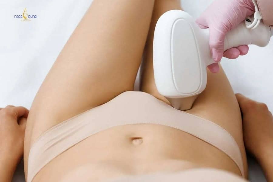 Triệt lông vùng kín có đau không còn phụ thuộc vào phương pháp triệt