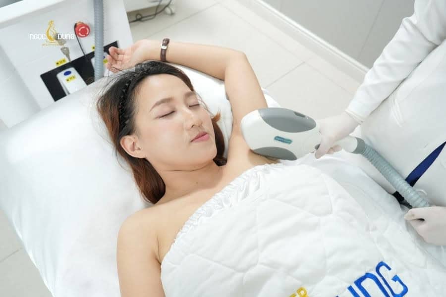Nên ưu tiên triệt lông công nghệ cao để giảm rủi ro ngứa da dưới cánh tay do kích ứng