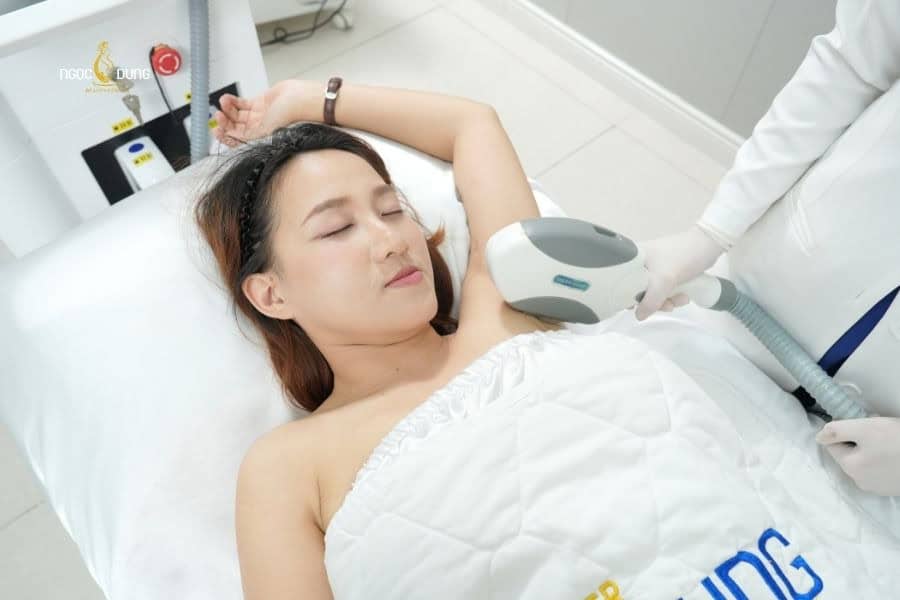 Triệt lông công nghệ cao là cách ngăn ngừa tình trạng lông nách mọc ngược hiệu quả nhất 