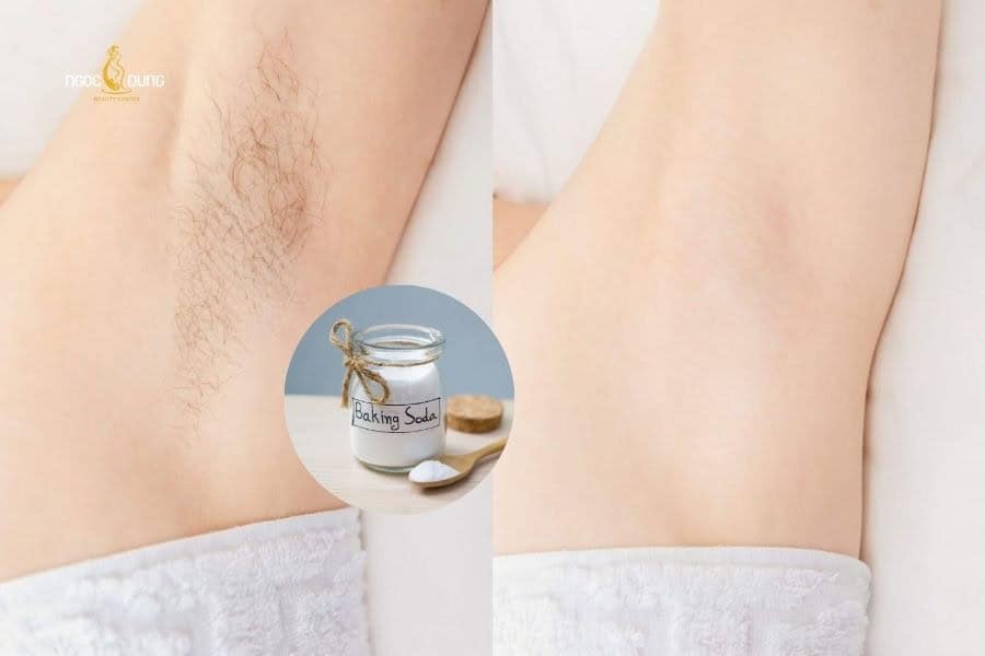 Tẩy lông nách bằng baking soda: Sự thật và cách dùng 8 Tẩy lông nách bằng baking soda còn hỗ trợ khử mùi ở vùng da dưới cánh tay
