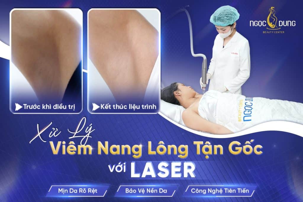 viem nang long moi