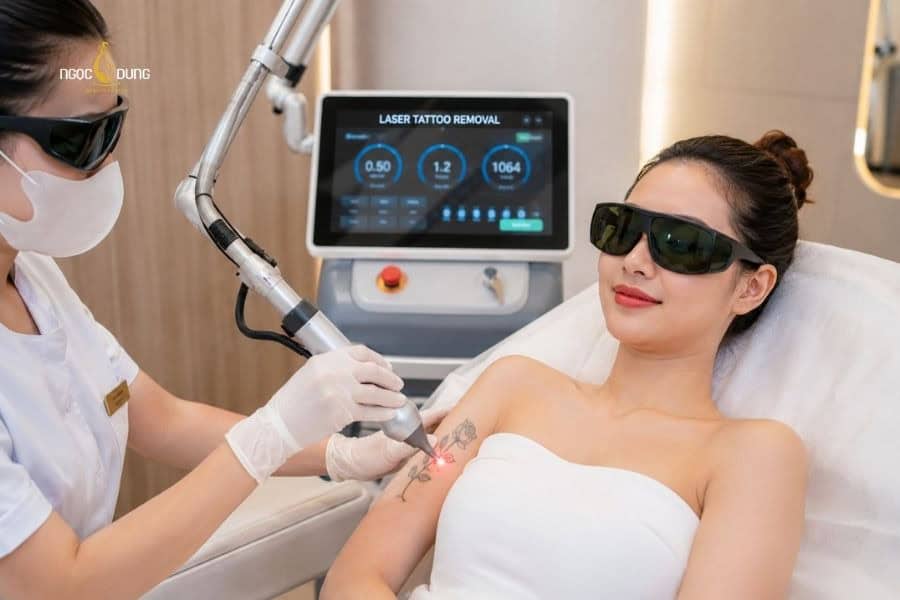Laser thường được ứng dụng trong xóa xăm an toàn và không xâm lấn da