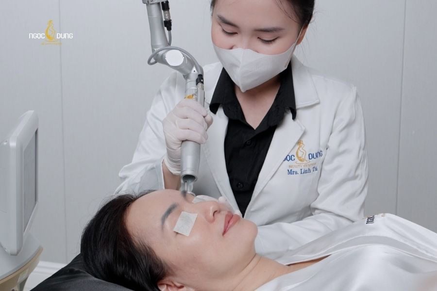 Ngọc Dung mang đến giải pháp xóa xăm chân mày hiện đại và hiệu quả