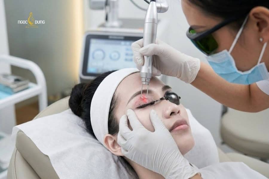 Xóa xăm mí mắt bằng công nghệ laser thế hệ mới là giải pháp tối ưu và an toàn nhất hiện nay