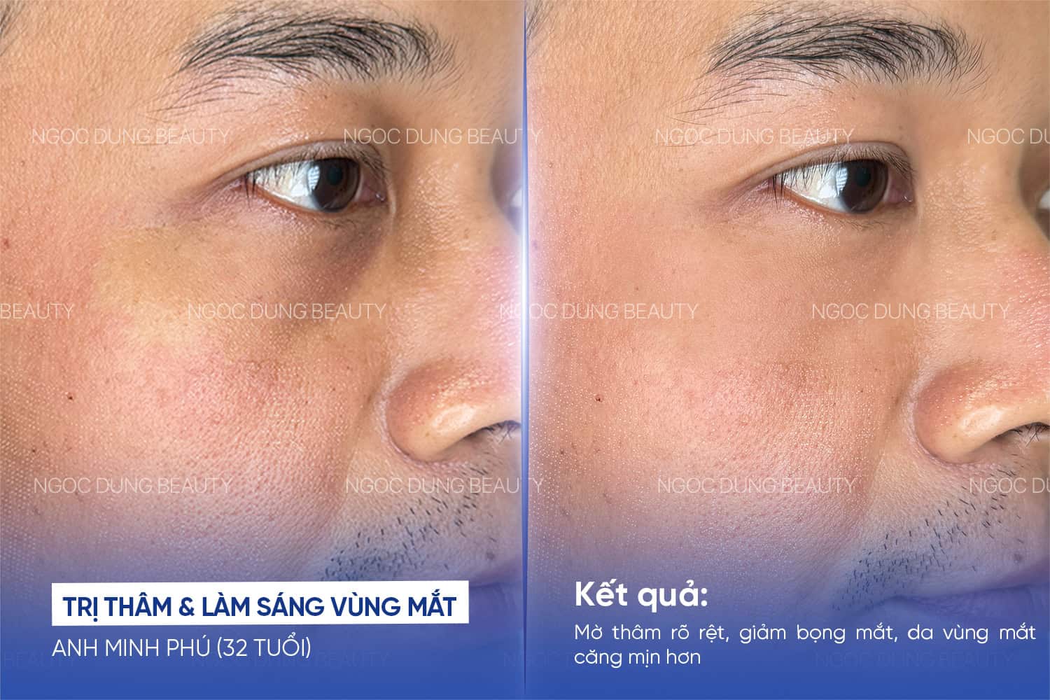 20260611 PosTM SEO 16 2
