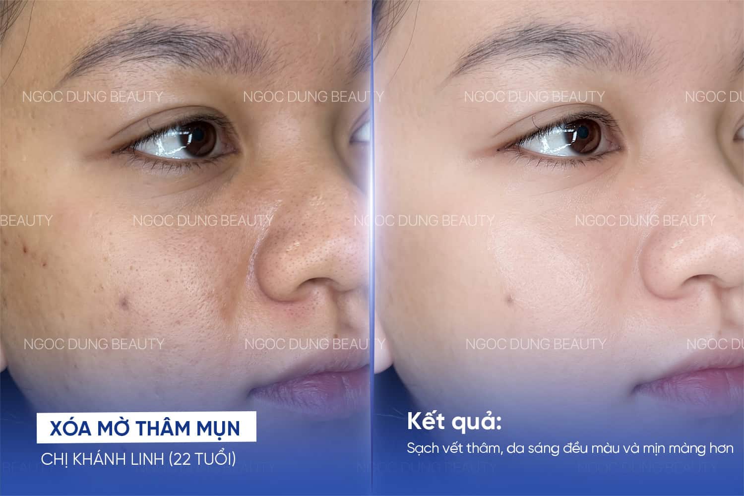 20260611 PosTM SEO 16 3 2