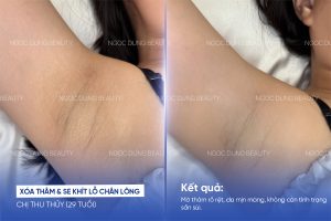 20260611 PosTM SEO 16 5