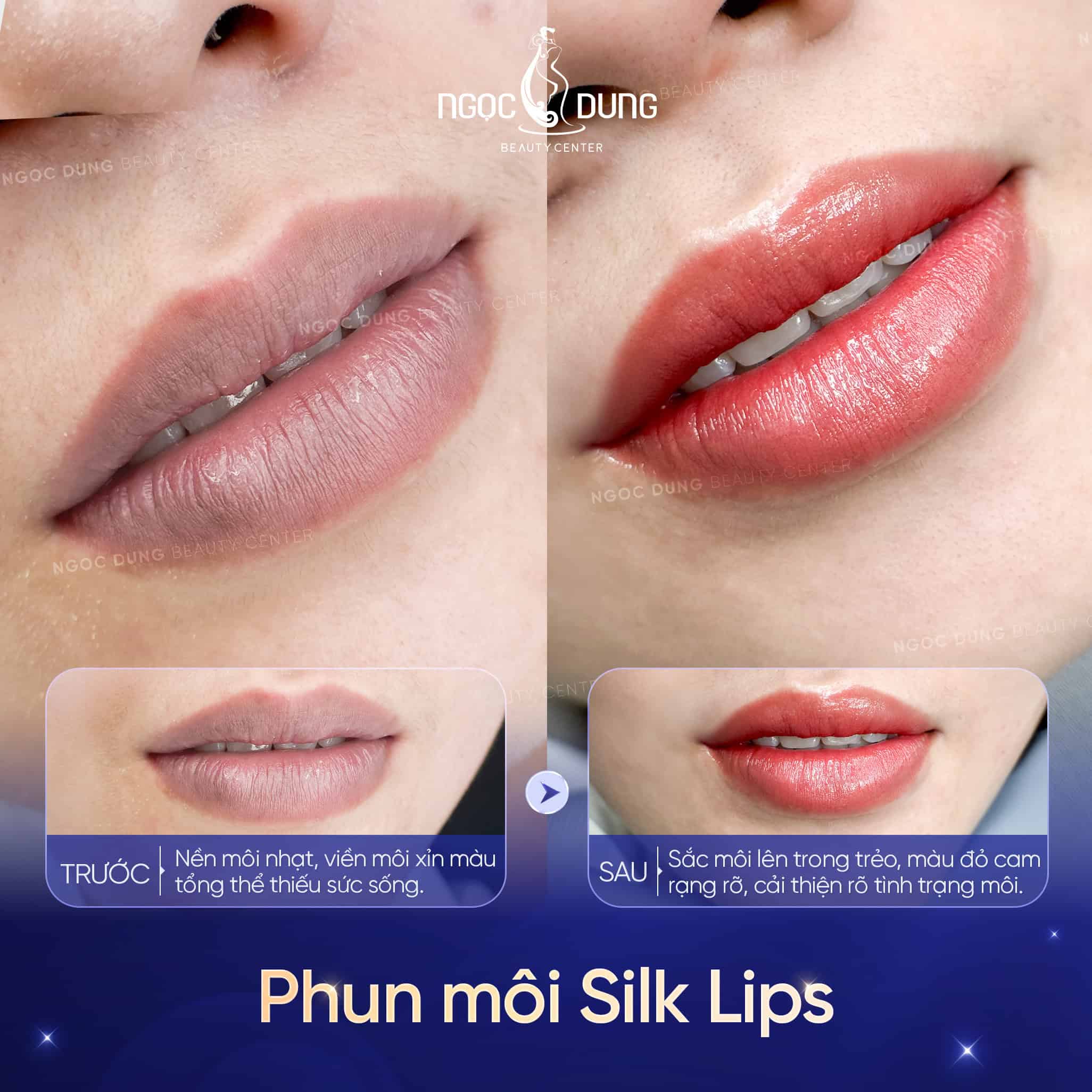 SILK LIPS