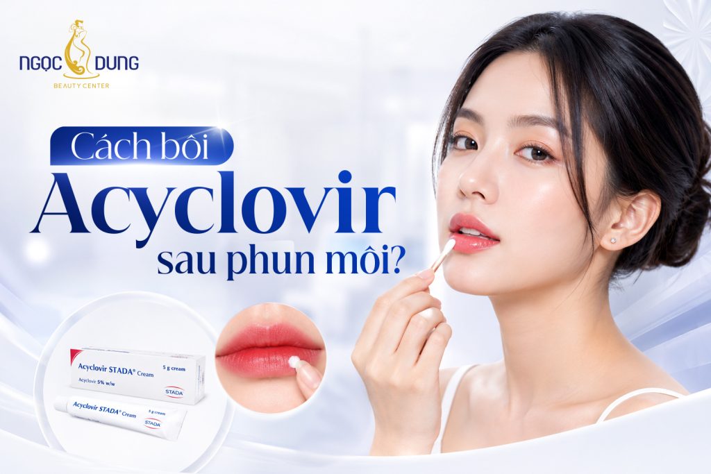 Cách bôi acyclovir sau phun môi an toàn từ chuyên gia