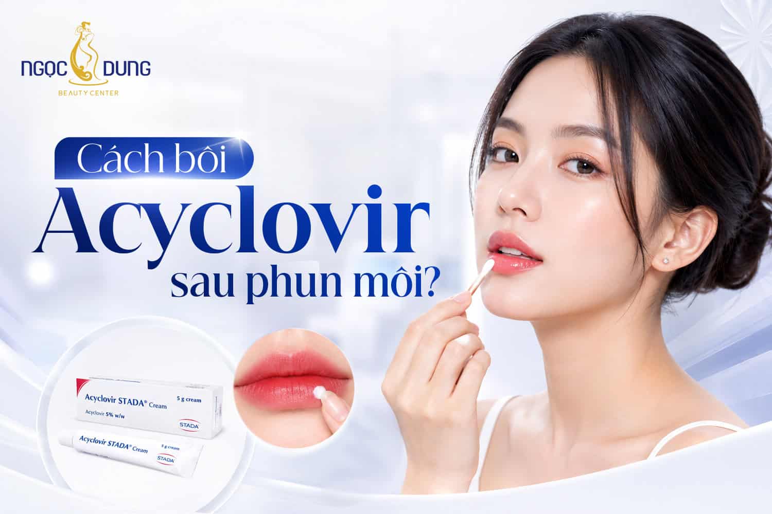 Cách bôi acyclovir sau phun môi an toàn từ chuyên gia