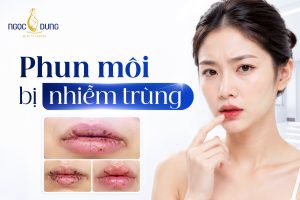 Phun môi bị nhiễm trùng: Dấu hiệu, nguyên nhân và xử lý