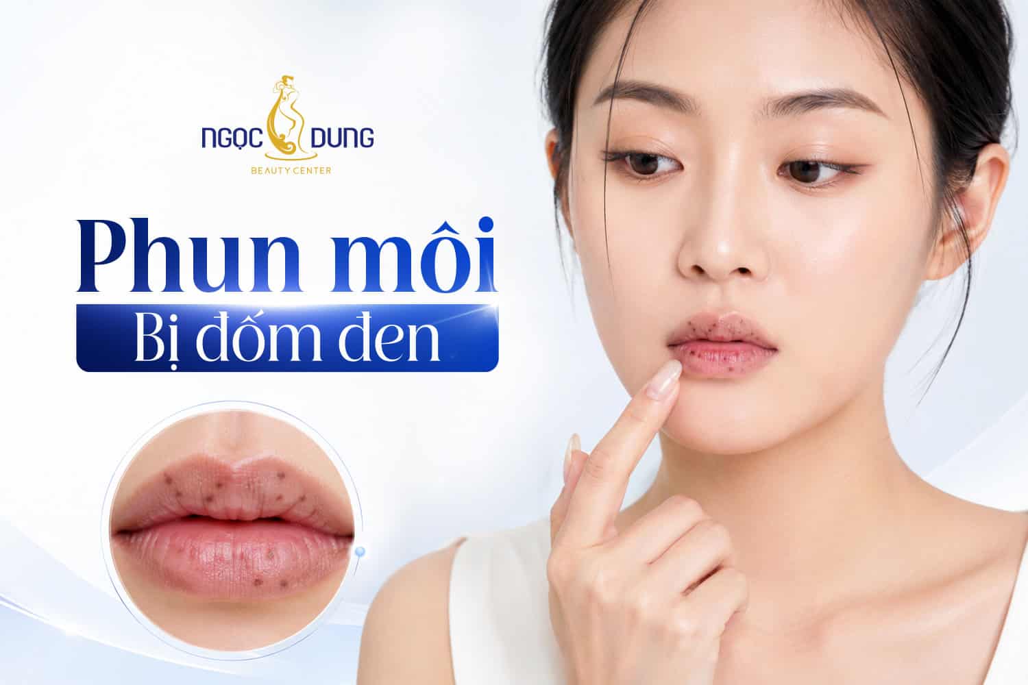 Phun môi bị đốm đen: Nguyên nhân và cách khắc phục