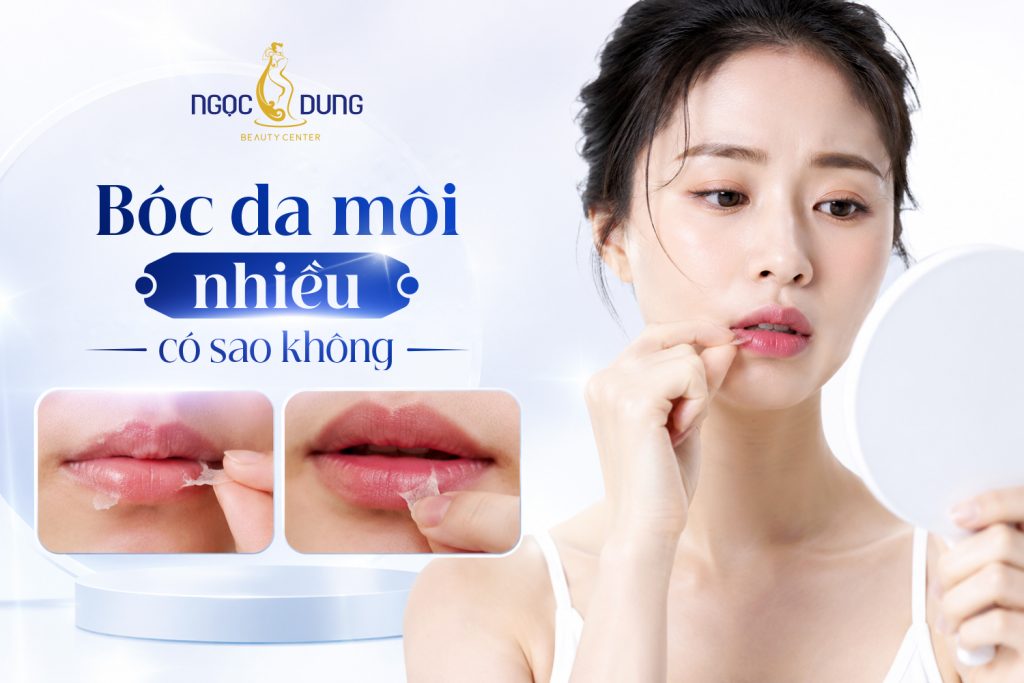 Bóc da môi nhiều có sao không? Hậu quả và cách xử lý