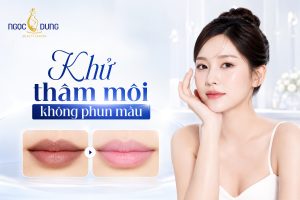Khử thâm môi không phun màu là gì? Màu nào hồng tự nhiên