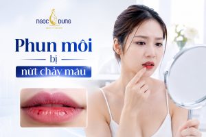 Phun môi bị nứt chảy máu: nguyên nhân và cách khắc phục