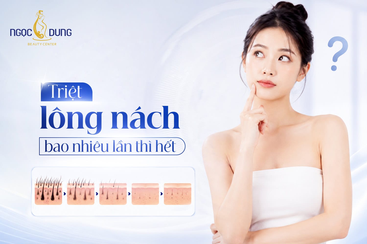 Triệt lông nách bao nhiêu lần thì hết? Giải đáp chi tiết