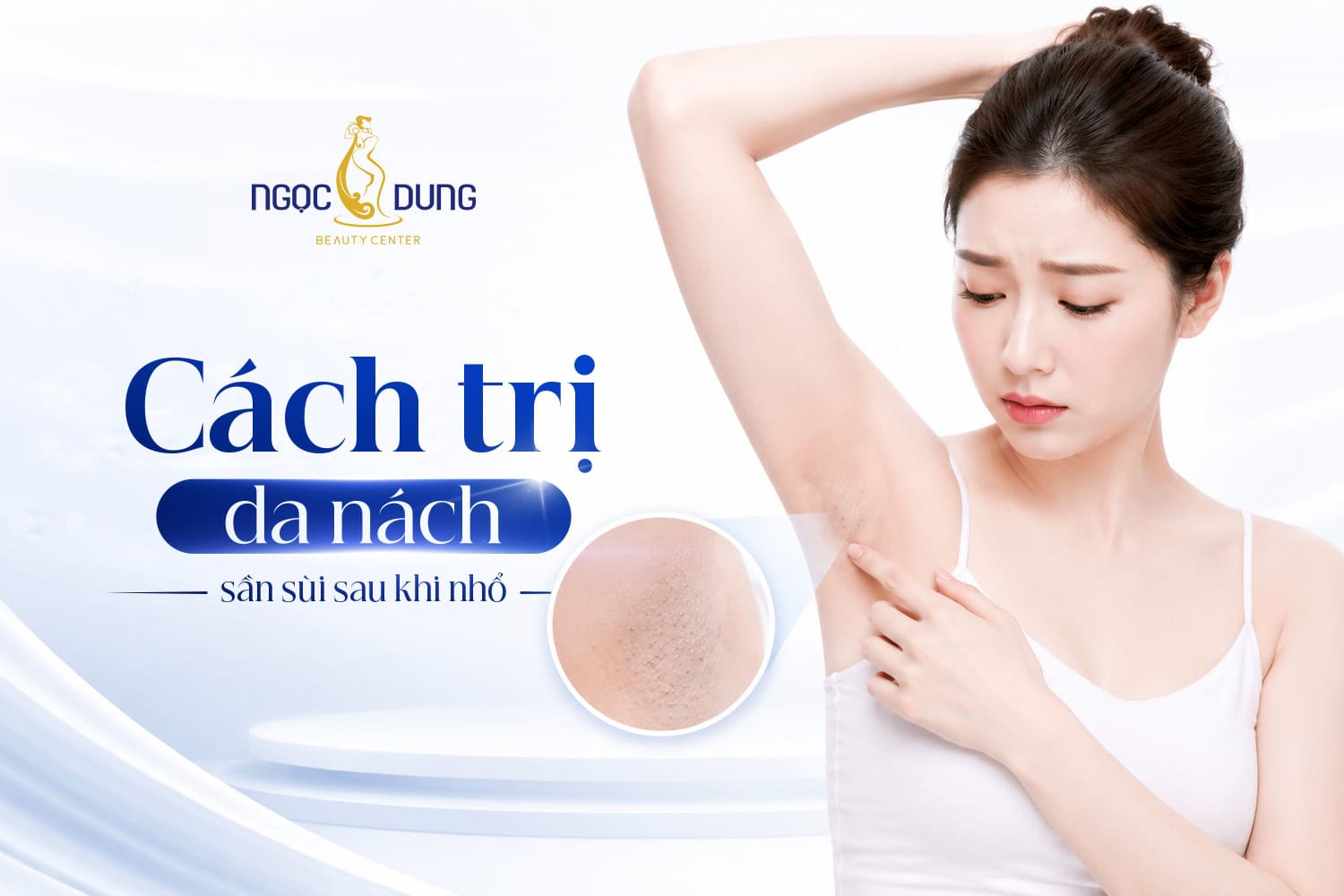 Cách trị da nách sần sùi sau khi nhổ lông hiệu quả nhanh