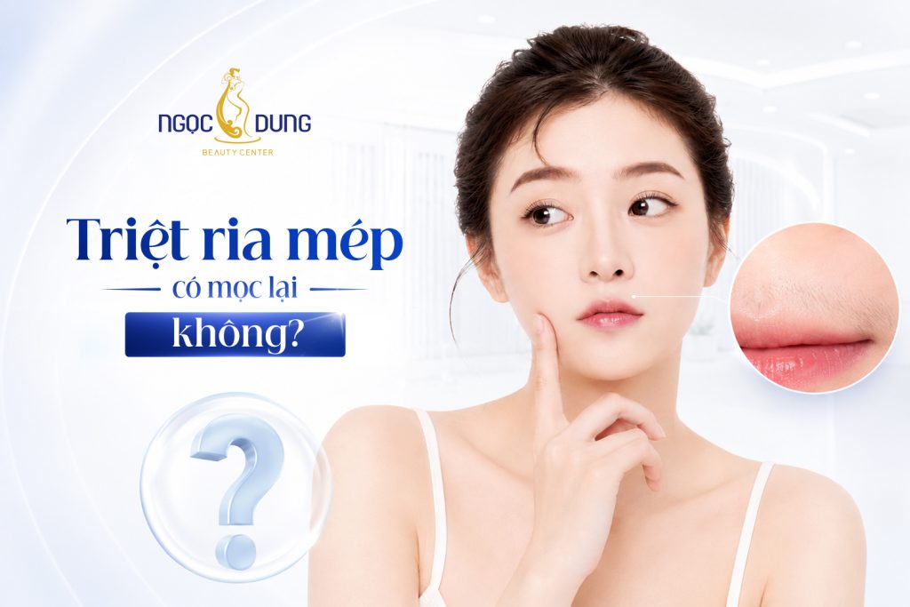 Triệt ria mép có mọc lại không? Bí quyết giữ hiệu quả