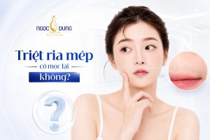 Triệt ria mép có mọc lại không? Bí quyết giữ hiệu quả