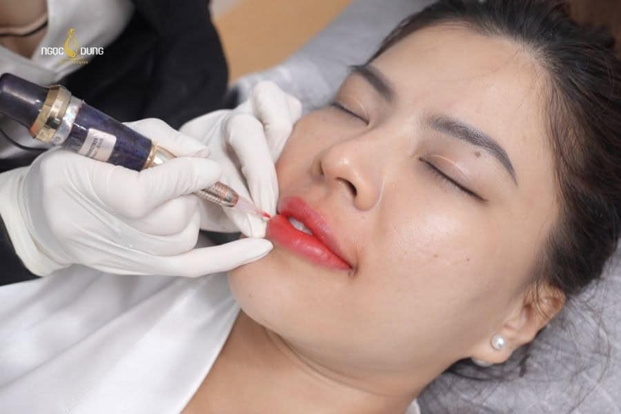 Phun môi dần thay thế các phương pháp xăm môi truyền thống
