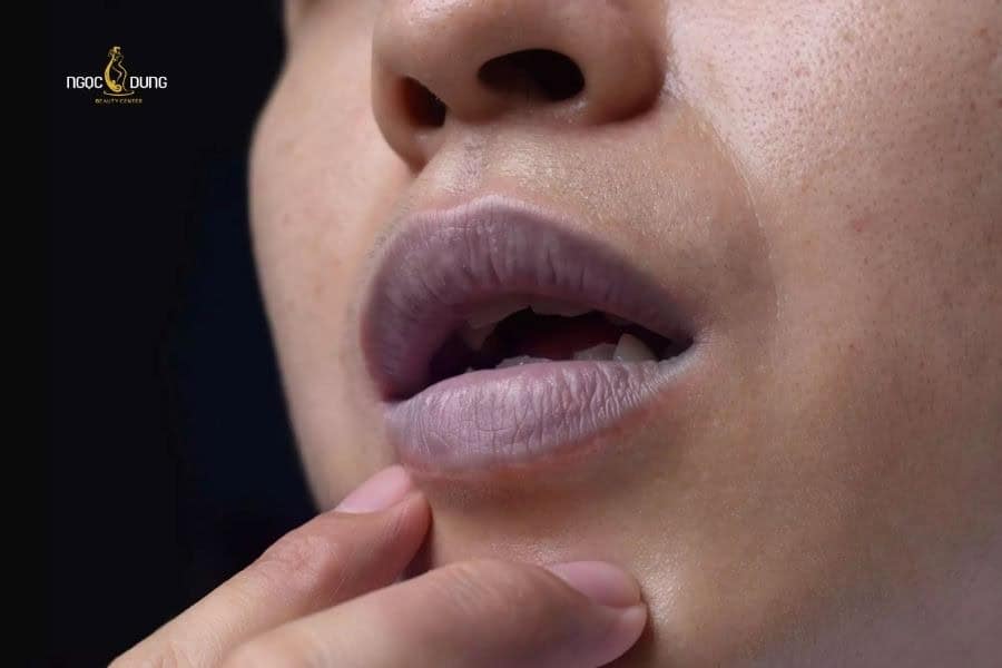Bóc da môi nhiều có sao không? Hậu quả và cách xử lý 3 Bóc da môi thường xuyên còn làm môi thâm sạm