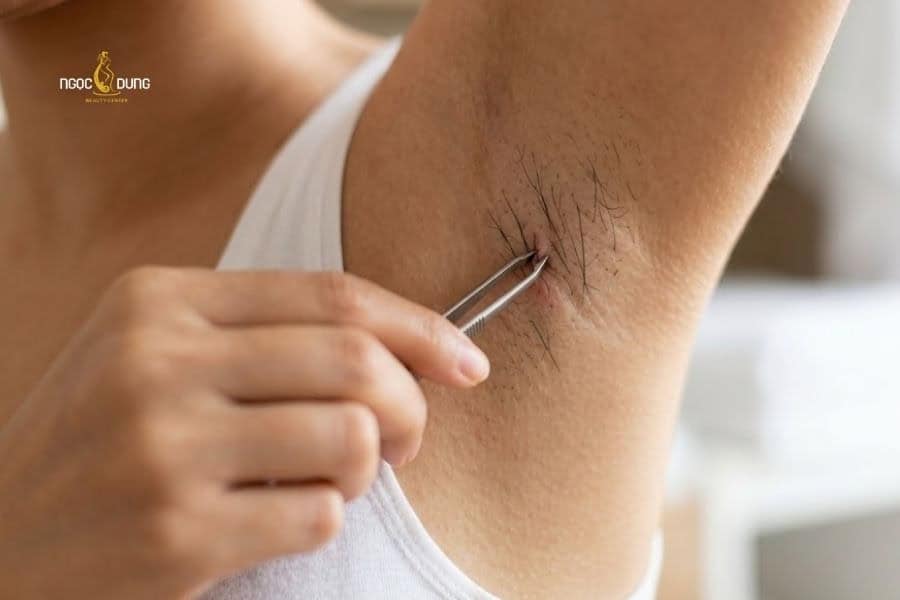 Hạn chế nhổ lông nách thường xuyên vì dễ gây đau và kích ứng vùng da nhạy cảm