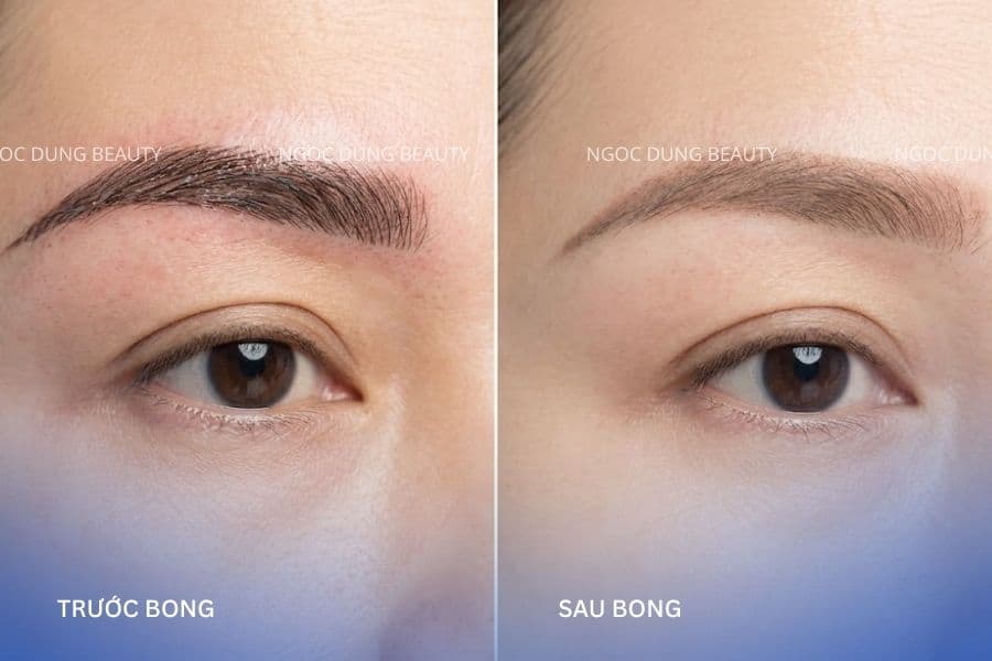 Giai đoạn bong vảy có thể khiến màu chân mày thay đổi rõ rệt 