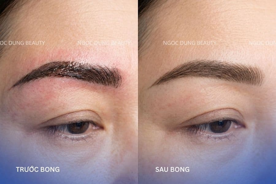 Độ đậm của màu của chân mày có thể thay đổi song khi bong lớp vảy