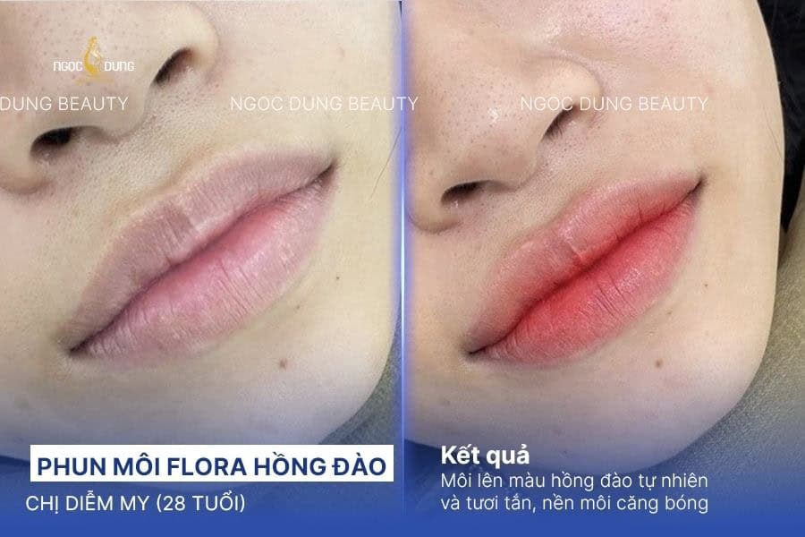 Có nên phun môi không? Ưu nhược điểm và những lưu ý 6 Kết quả phun môi flora màu hồng đào tự nhiên
